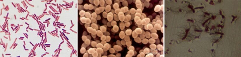 Escherichia Sticks, Fecal Enterococcus και Pro - Τα κύρια παθογόνα της χρόνιας βακτηριακής προστατίτιδας